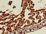 SnoN Antibody in Immunohistochemistry (Paraffin) (IHC (P))