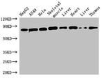 SnoN Antibody in Western Blot (WB)