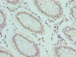 SLC1A6 Antibody in Immunohistochemistry (Paraffin) (IHC (P))