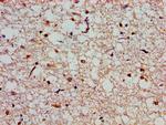 SLC25A12 Antibody in Immunohistochemistry (Paraffin) (IHC (P))