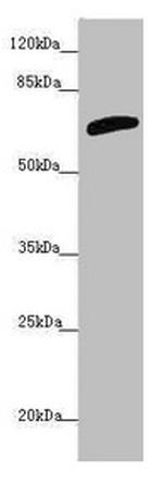 SLC6A12 Antibody in Western Blot (WB)