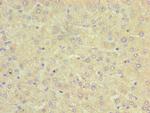 Sorcin Antibody in Immunohistochemistry (Paraffin) (IHC (P))