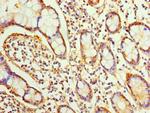 Sorcin Antibody in Immunohistochemistry (Paraffin) (IHC (P))