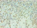 TDP1 Antibody in Immunohistochemistry (Paraffin) (IHC (P))