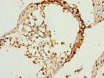 TIMM23 Antibody in Immunohistochemistry (Paraffin) (IHC (P))