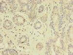 TK1 Antibody in Immunohistochemistry (Paraffin) (IHC (P))