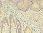 TK1 Antibody in Immunohistochemistry (Paraffin) (IHC (P))