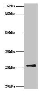 TK1 Antibody in Western Blot (WB)