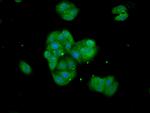 Tankyrase Antibody in Immunocytochemistry (ICC/IF)