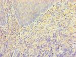 TRPM2 Antibody in Immunohistochemistry (Paraffin) (IHC (P))