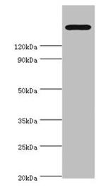 TRPM2 Antibody in Western Blot (WB)