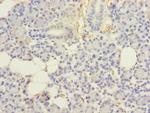 UBE2G2 Antibody in Immunohistochemistry (Paraffin) (IHC (P))