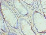 UBE2V2 Antibody in Immunohistochemistry (Paraffin) (IHC (P))