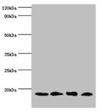 UBE2V2 Antibody in Western Blot (WB)