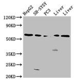 UGT1A1 Antibody in Western Blot (WB)