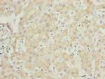 UQCRC1 Antibody in Immunohistochemistry (Paraffin) (IHC (P))