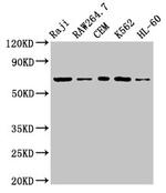 Zap-70 Antibody in Western Blot (WB)