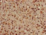 HSC70 Antibody in Immunohistochemistry (Paraffin) (IHC (P))