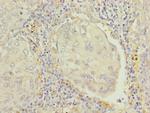 RAP1B Antibody in Immunohistochemistry (Paraffin) (IHC (P))