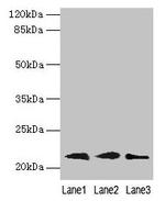 RAP1B Antibody in Western Blot (WB)