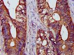 BAP31 Antibody in Immunohistochemistry (Paraffin) (IHC (P))