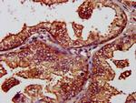 BAP31 Antibody in Immunohistochemistry (Paraffin) (IHC (P))