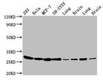 BAP31 Antibody in Western Blot (WB)