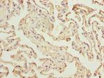 RAD23A Antibody in Immunohistochemistry (Paraffin) (IHC (P))