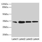 RAD23A Antibody in Western Blot (WB)