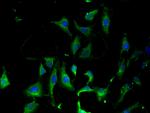 KARS Antibody in Immunocytochemistry (ICC/IF)