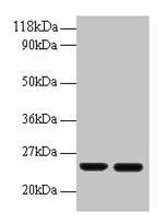 RBP4 Antibody in Western Blot (WB)