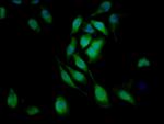 CD171 (L1CAM) Antibody in Immunocytochemistry (ICC/IF)