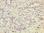 VEGFC Antibody in Immunohistochemistry (Paraffin) (IHC (P))