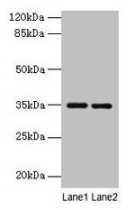 Thrombopoietin Antibody in Western Blot (WB)