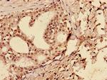 p53 Antibody in Immunohistochemistry (Paraffin) (IHC (P))