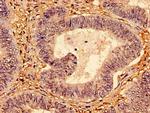 p53 Antibody in Immunohistochemistry (Paraffin) (IHC (P))