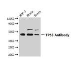 p53 Antibody in Western Blot (WB)