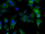 PAI1 Antibody in Immunocytochemistry (ICC/IF)