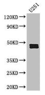 PAI1 Antibody in Western Blot (WB)