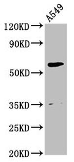 AMH Antibody in Western Blot (WB)