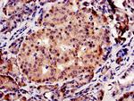 CBS Antibody in Immunohistochemistry (Paraffin) (IHC (P))