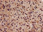 CBS Antibody in Immunohistochemistry (Paraffin) (IHC (P))