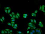 Kininogen Light Chain Antibody in Immunocytochemistry (ICC/IF)