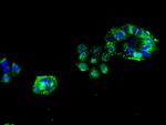 CHRNB1 Antibody in Immunocytochemistry (ICC/IF)