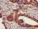 CHRNB1 Antibody in Immunohistochemistry (Paraffin) (IHC (P))