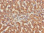 CHRNB1 Antibody in Immunohistochemistry (Paraffin) (IHC (P))