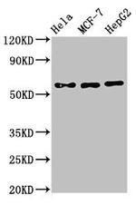 CHRNB1 Antibody in Western Blot (WB)