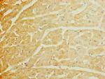 SCN7A Antibody in Immunohistochemistry (Paraffin) (IHC (P))