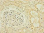 SCN7A Antibody in Immunohistochemistry (Paraffin) (IHC (P))