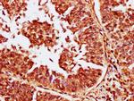 CABIN1 Antibody in Immunohistochemistry (Paraffin) (IHC (P))